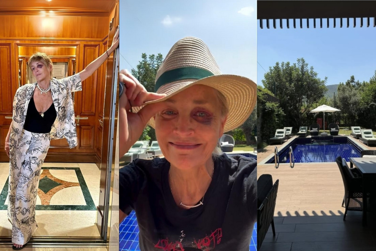 Sharon Stone gözünü morarttı 12 sharon stone mor goz bodrum