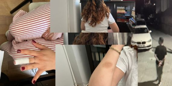 Uyurken yatağında saldırıya uğradı 17 images