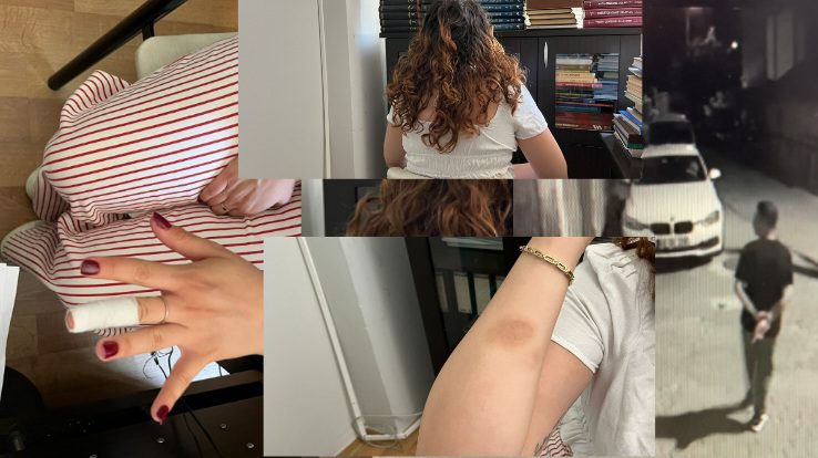 Uyurken yatağında saldırıya uğradı 4 images 21