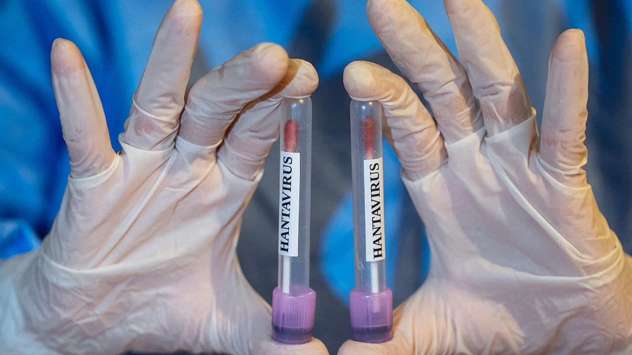 Hantavirüs vakalarında korkutan gelişme 1 hanta virus 2459282