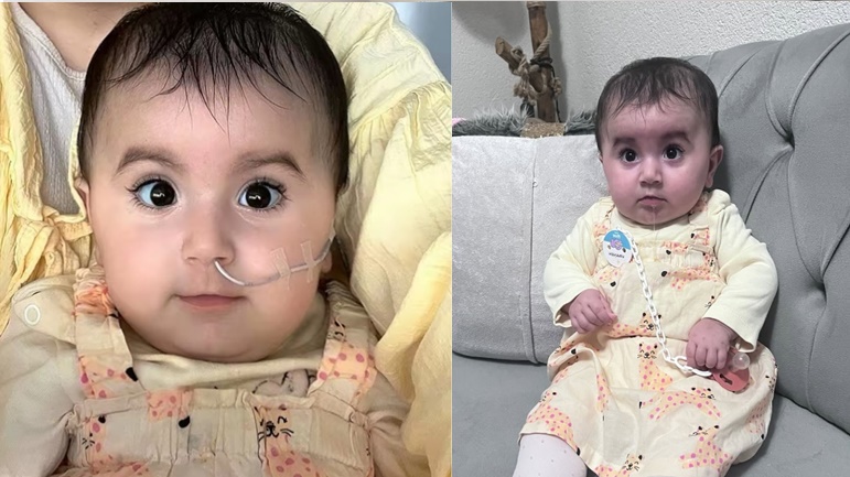 Bodrum'da 7 aylık SMA TİP-1 hastası Samira yardımlarınızı bekliyor 10 acil tip anabilimdali 1