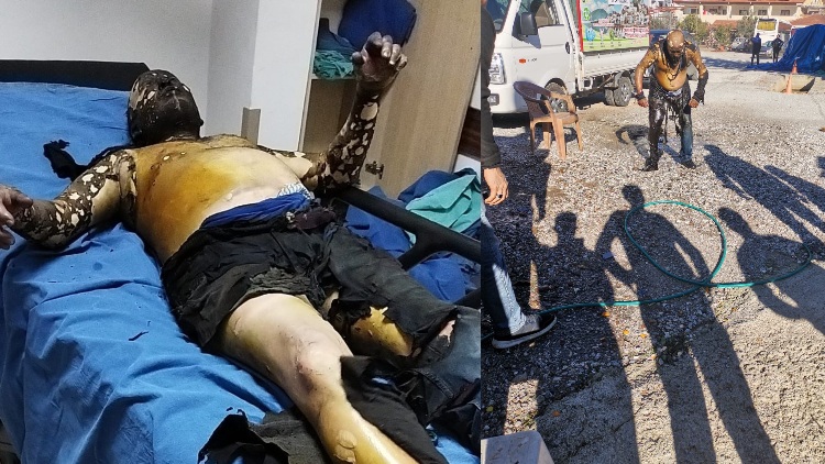 Zabıta Baskı Yapınca Üzerine Benzin Döken Adam Hayatını Kaybetti 13 61e681b44e3fe11f5862f1f3 4